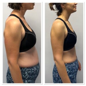 His approach made training enjoyable yet challenging, and he always knew when to push me further while keeping things realistic and sustainable. I not only transformed my body but also gained confidence in my strength and abilities.  I feel fitter, stronger, and healthier than ever, and I’m so glad I committed to this journey. Darren’s support and expertise truly made all the difference!”